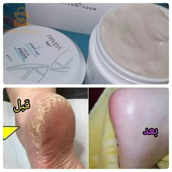 كريم القدمين لقدمين أكثر تشقق
