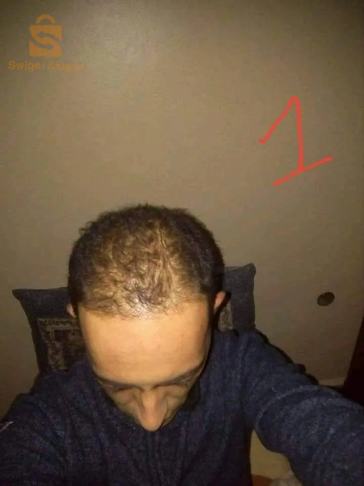 منتوج طبيعي 100% لتقوية الشعر والحد من تساقطه في وقت وجيز
