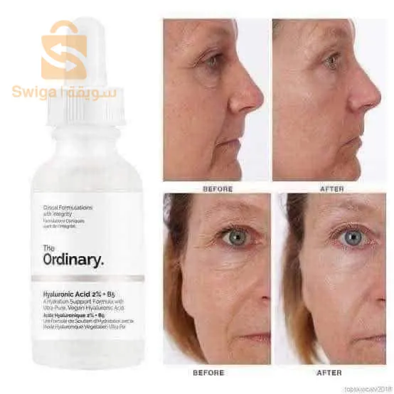 serum