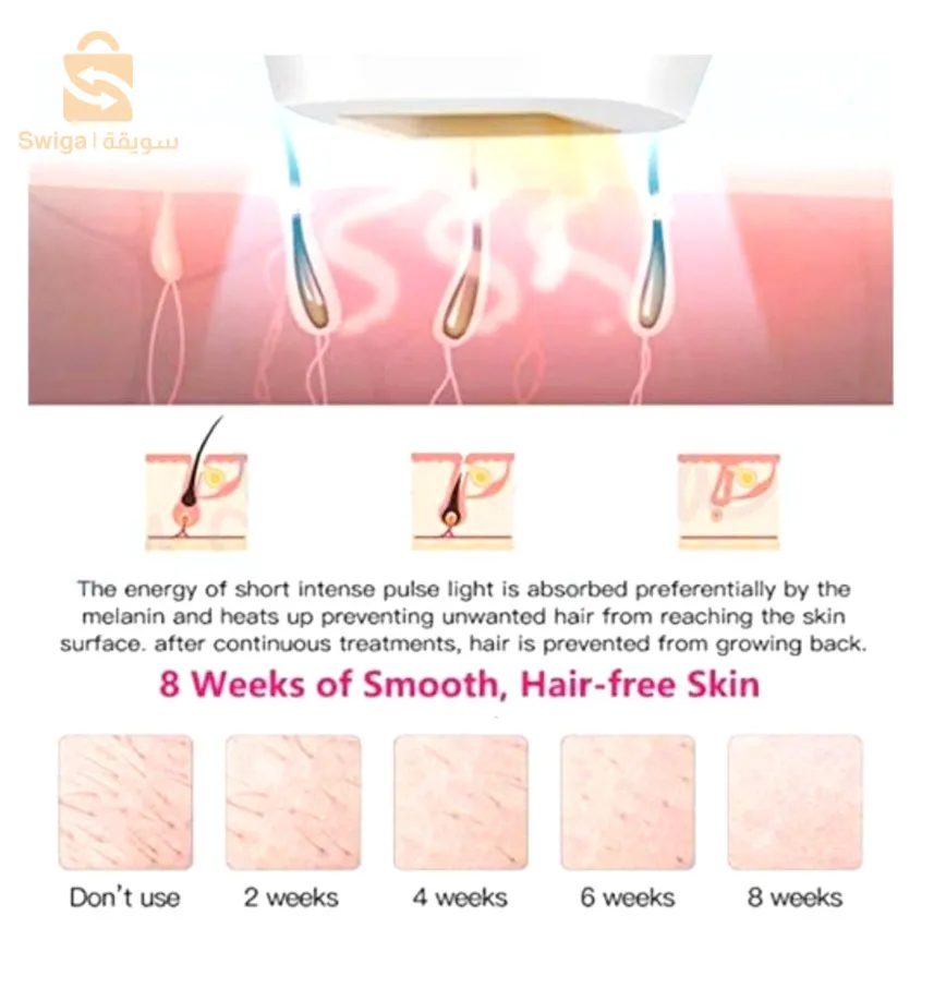 جهاز ليزر لإزالة الشعر