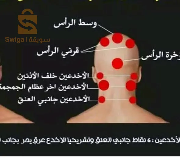 دورة تعليمية في الحجامة