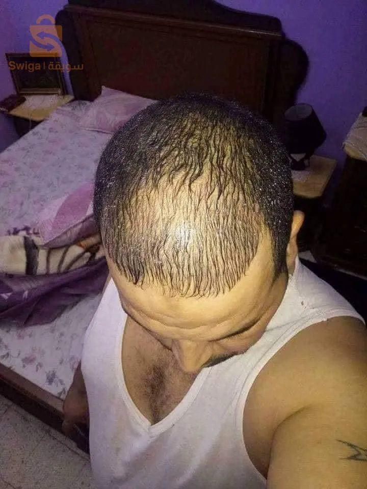 منتوج طبيعي 100% لتقوية الشعر والحد من تساقطه في وقت وجيز
