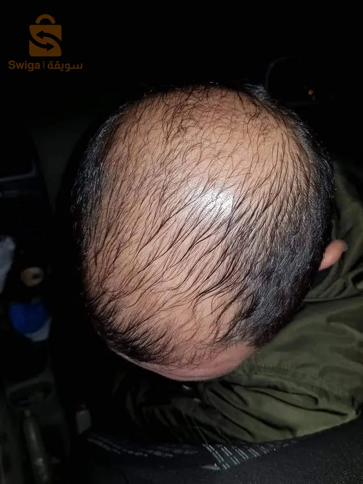 منتوج طبيعي 100% لتقوية الشعر والحد من تساقطه في وقت وجيز