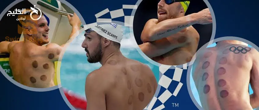 دورة تعليمية في الحجامة