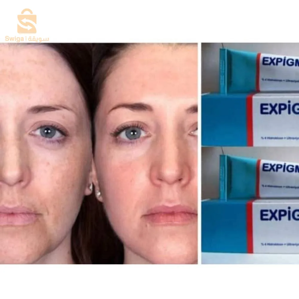 Expigment crème (30g)