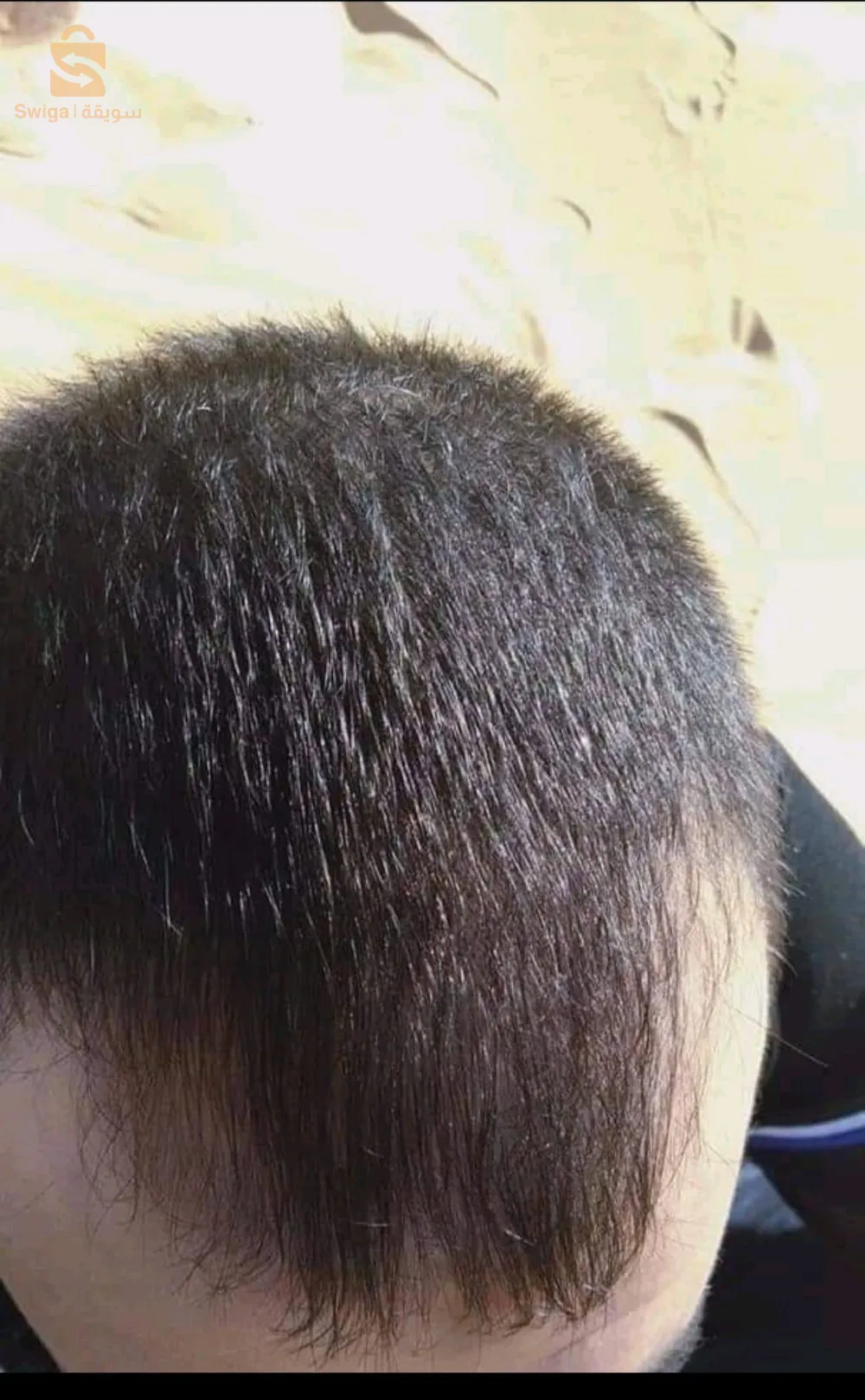 منتوج طبيعي 100% لتقوية الشعر والحد من تساقطه في وقت وجيز