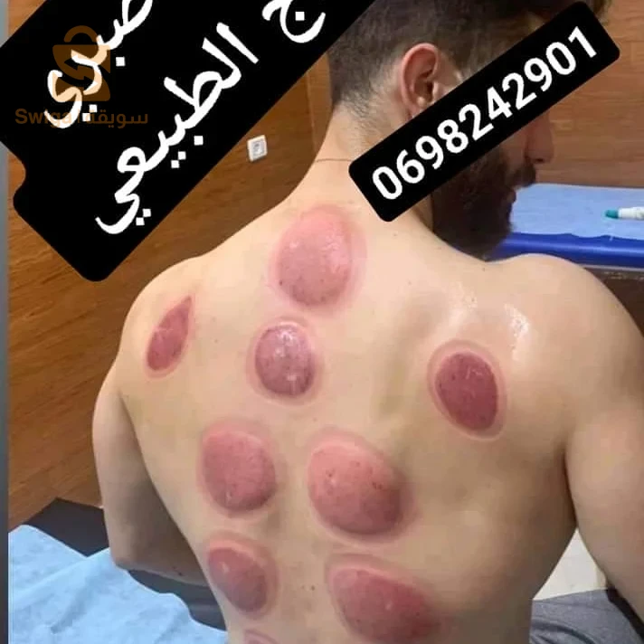 حجامة وقائية لممارس رياضة كمال الاجسام