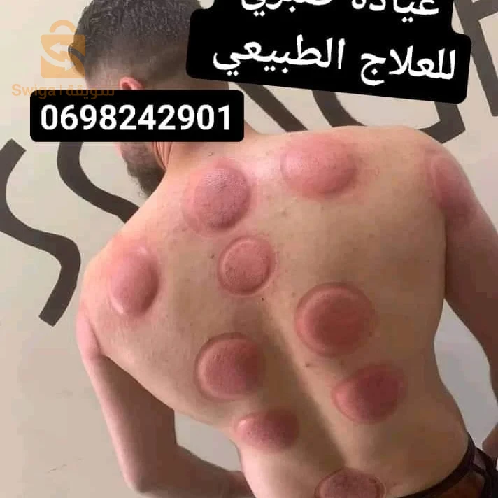 حجامة وقائية لممارس رياضة كمال الاجسام