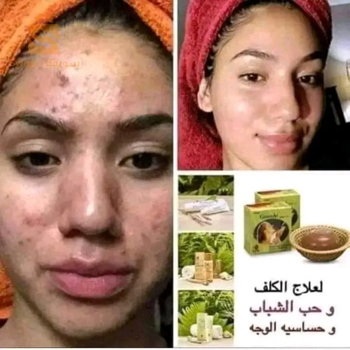 مكملات غذائية طبيعية و الصحة