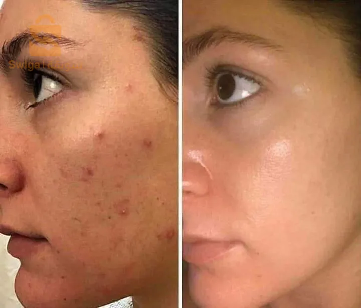 The ordinary Glycolic acid 7%🥰