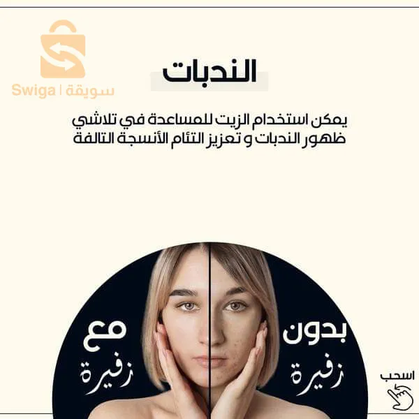 زيت  بذور التين الشوكي