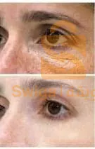 The Ordinary Solution à la Cafeine 5% + EGCG - Contour des Yeux