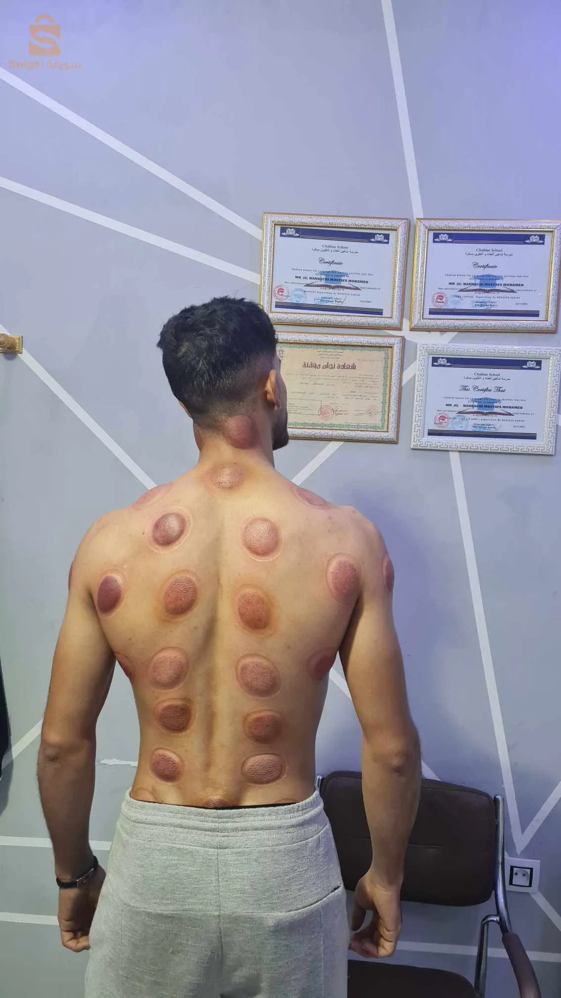 مركز الشفاء للحجامة و العناية الجسدية ليشانة