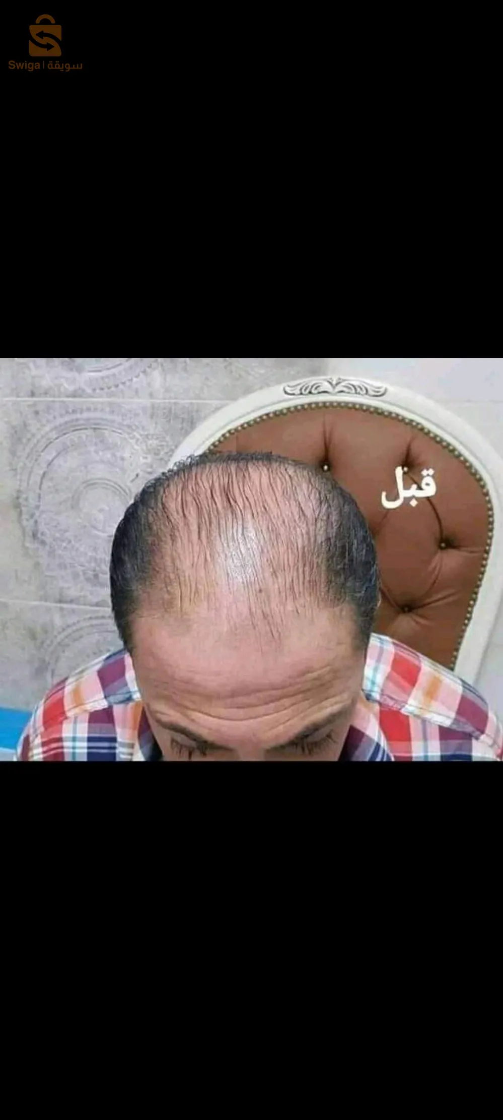 الزيت السحري لتنبيت الشعر وملء الفراغات غني بالفيتامينات والبروتينات التي تحتاج لها فروه الراس