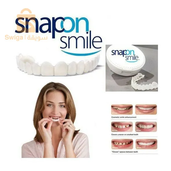 تركيبة أسنان هوليود سمايل-Fausses Dents Ajustement Parfait, Blanchiment Dentaire