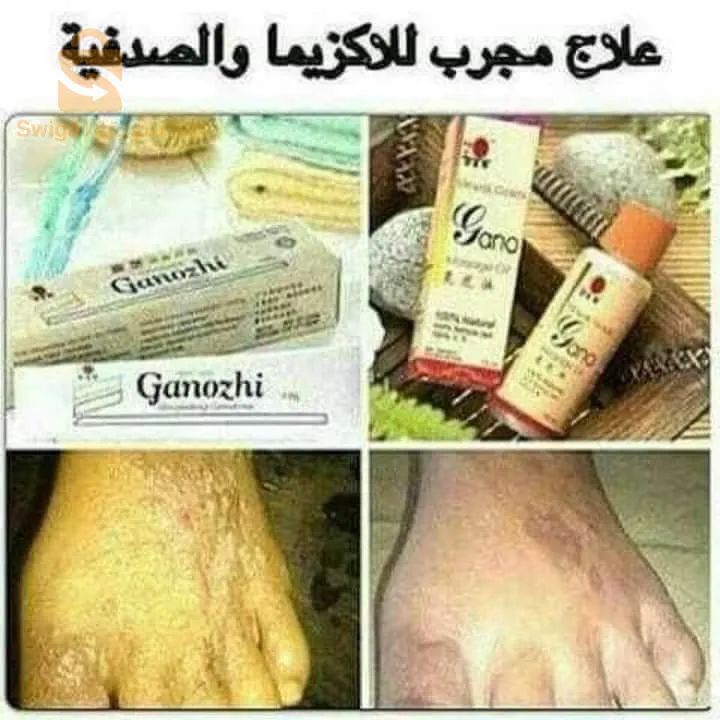 علاجات و عناية بالجسم
