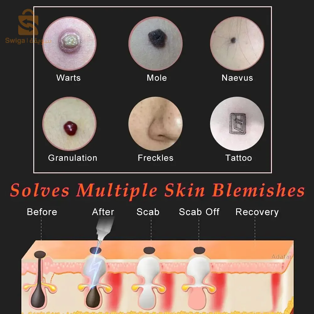 Stylo d'élimination des taupes au laser plasma pour enlever les taches de rousseur de la peau du maïs et les verrues électrique Dark Tag Nevus Pimple Spot Tattoo Traitement anti-rides