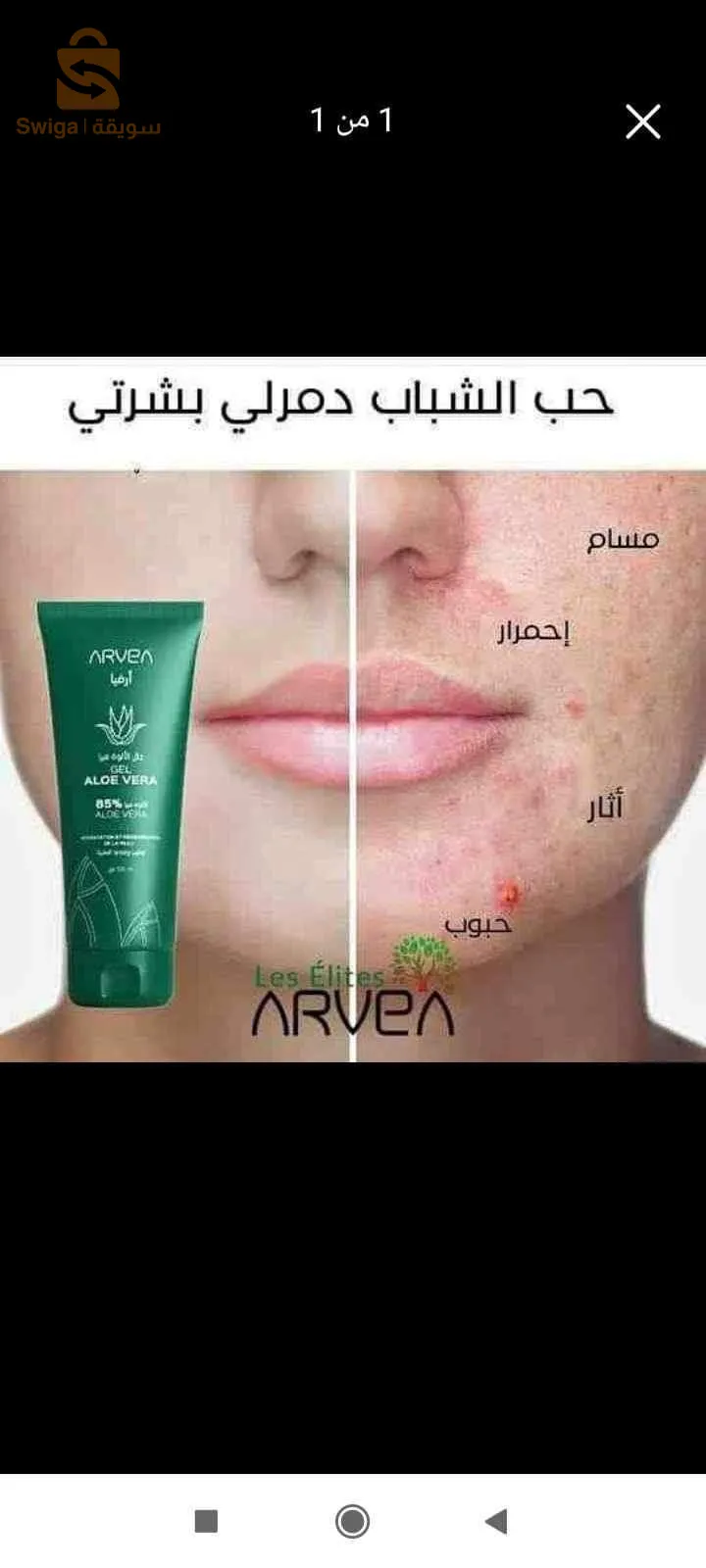 جال الاوة فيرا الحل الفعال للقضاء على مشكل حب الشباب