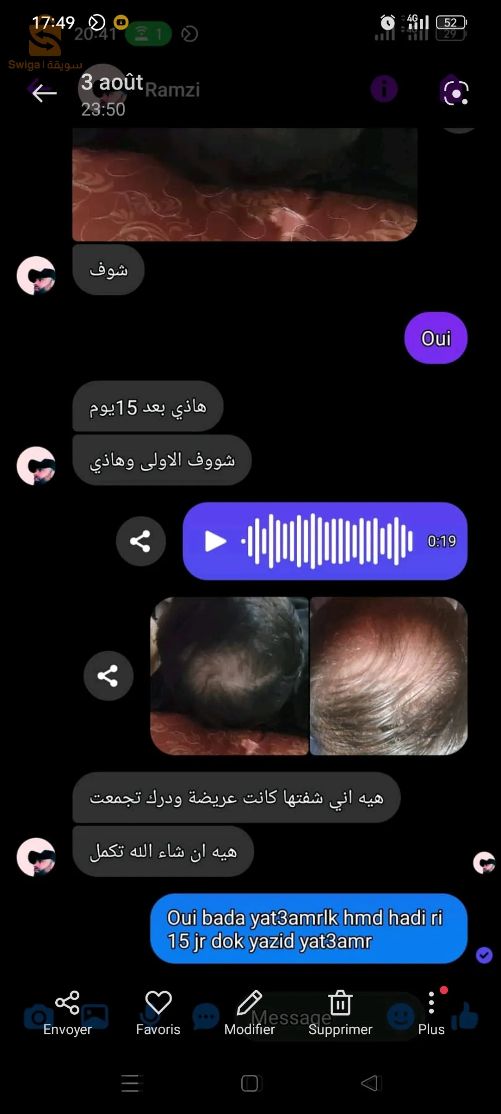 الزيت السحري لتنبيت الشعر وملء الفراغات غني بالفيتامينات والبروتينات التي تحتاج لها فروه الراس