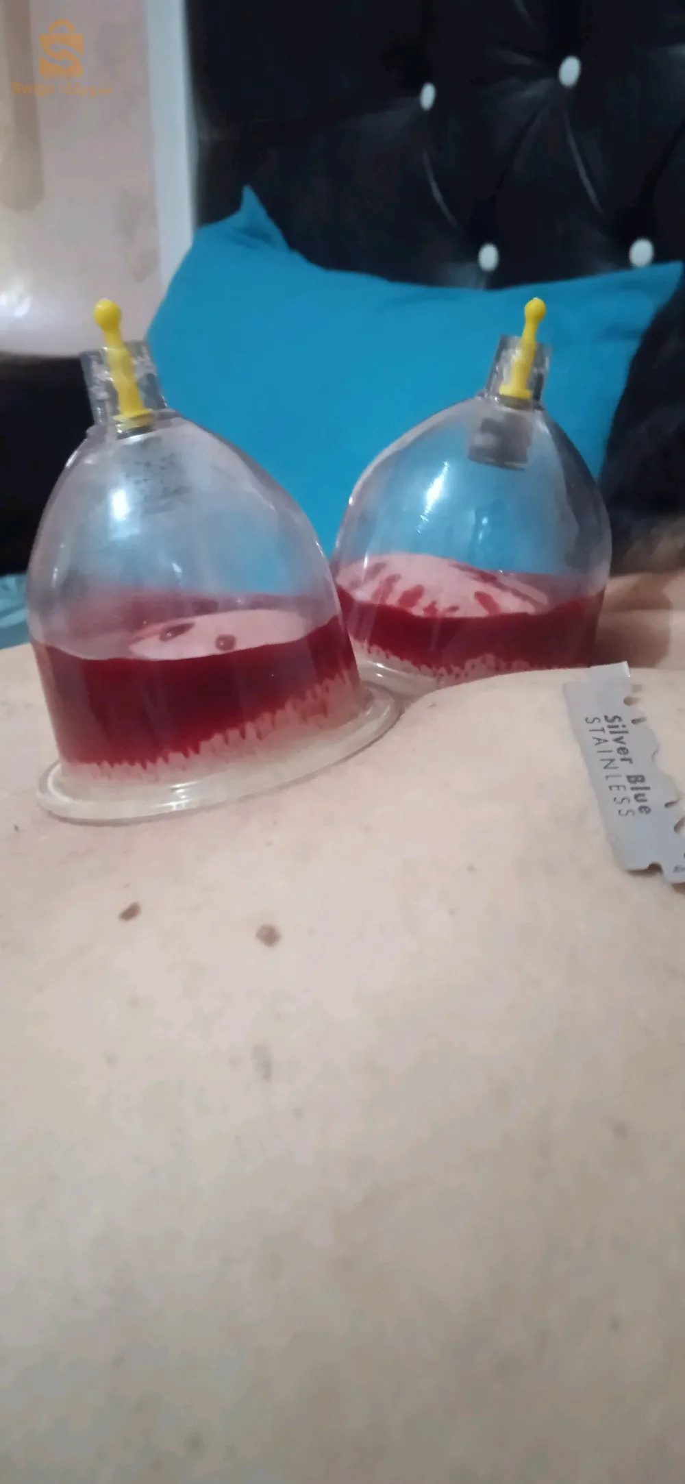 العلاج بالطب البديل