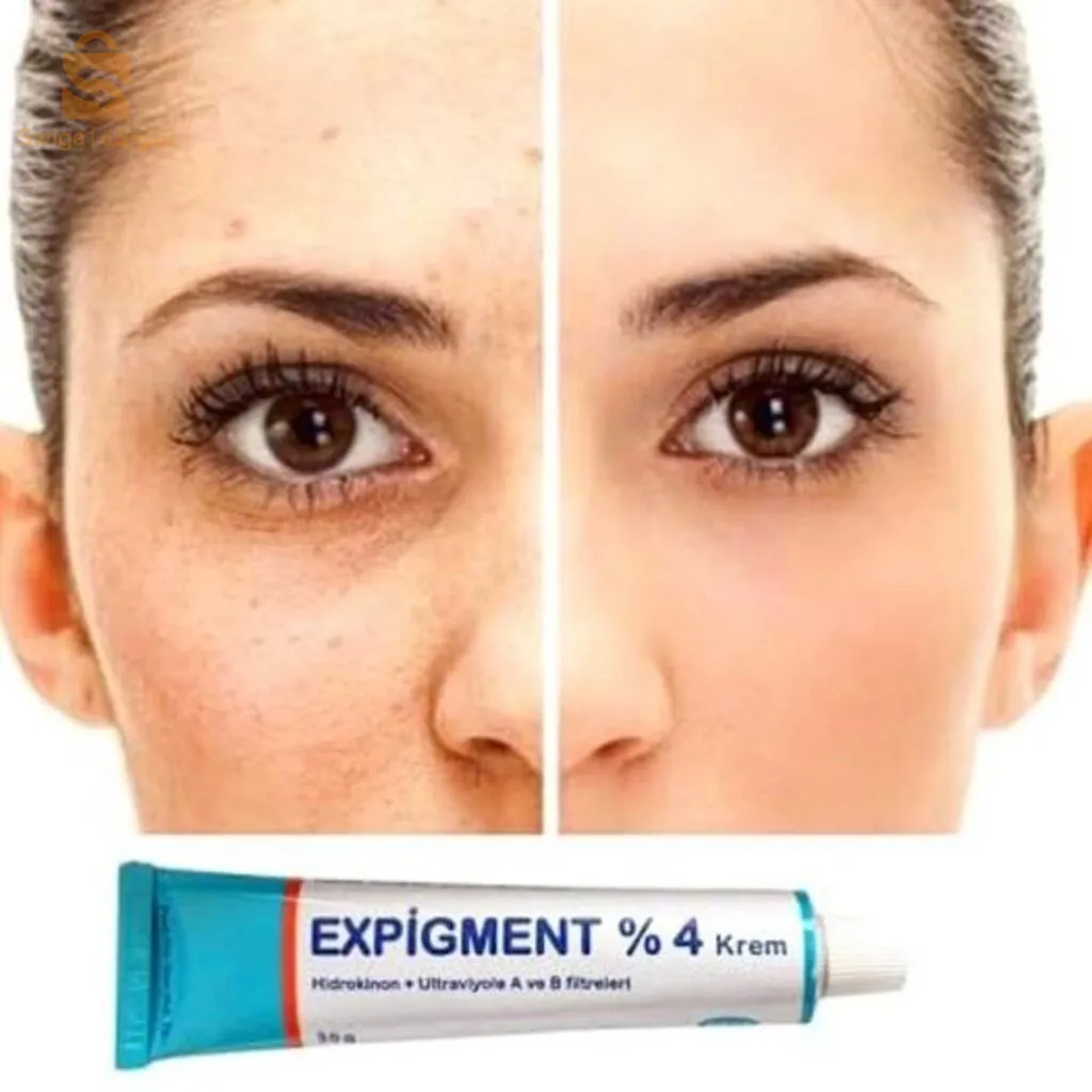 كريم expigment
