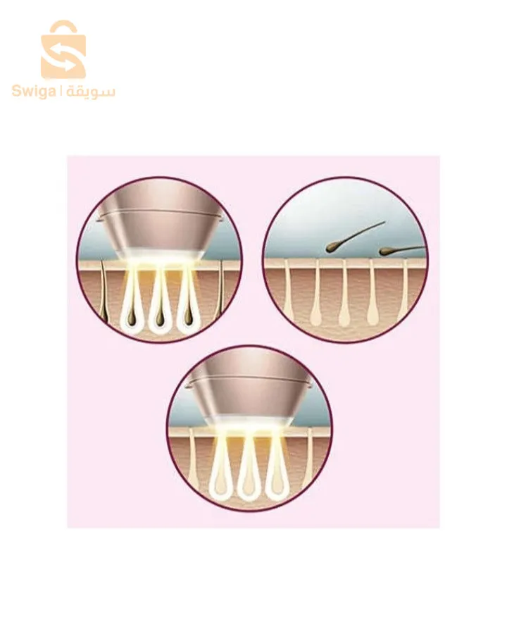 جهاز إزالة الشعر نهائيا بالليزر