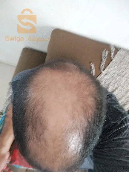 زيت إكليل الجبل ميلي