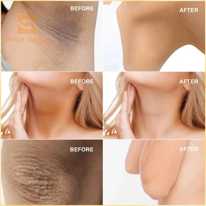 Expigment 4 كريم