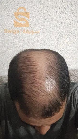 زيت إكليل الجبل ميلي