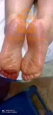 كريم تشقق الأقدام
