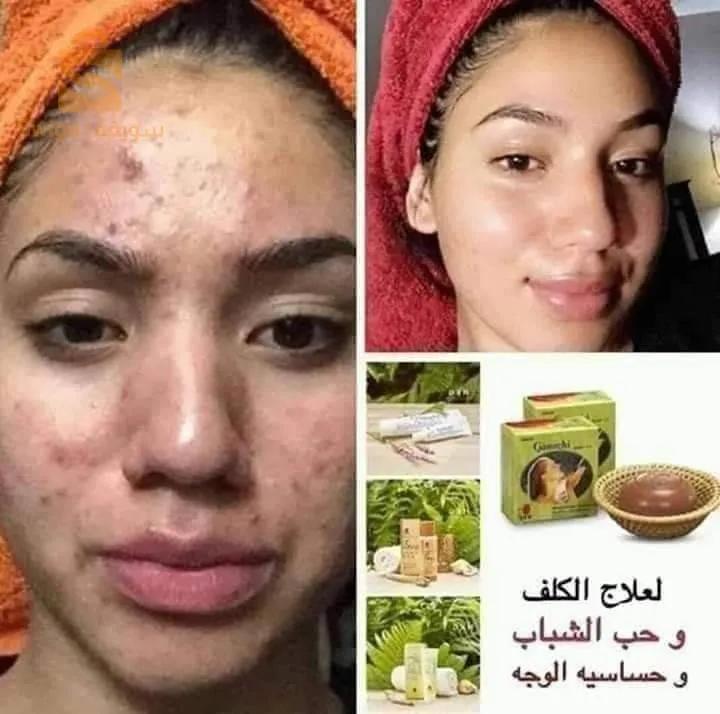 صابون الجانوزي