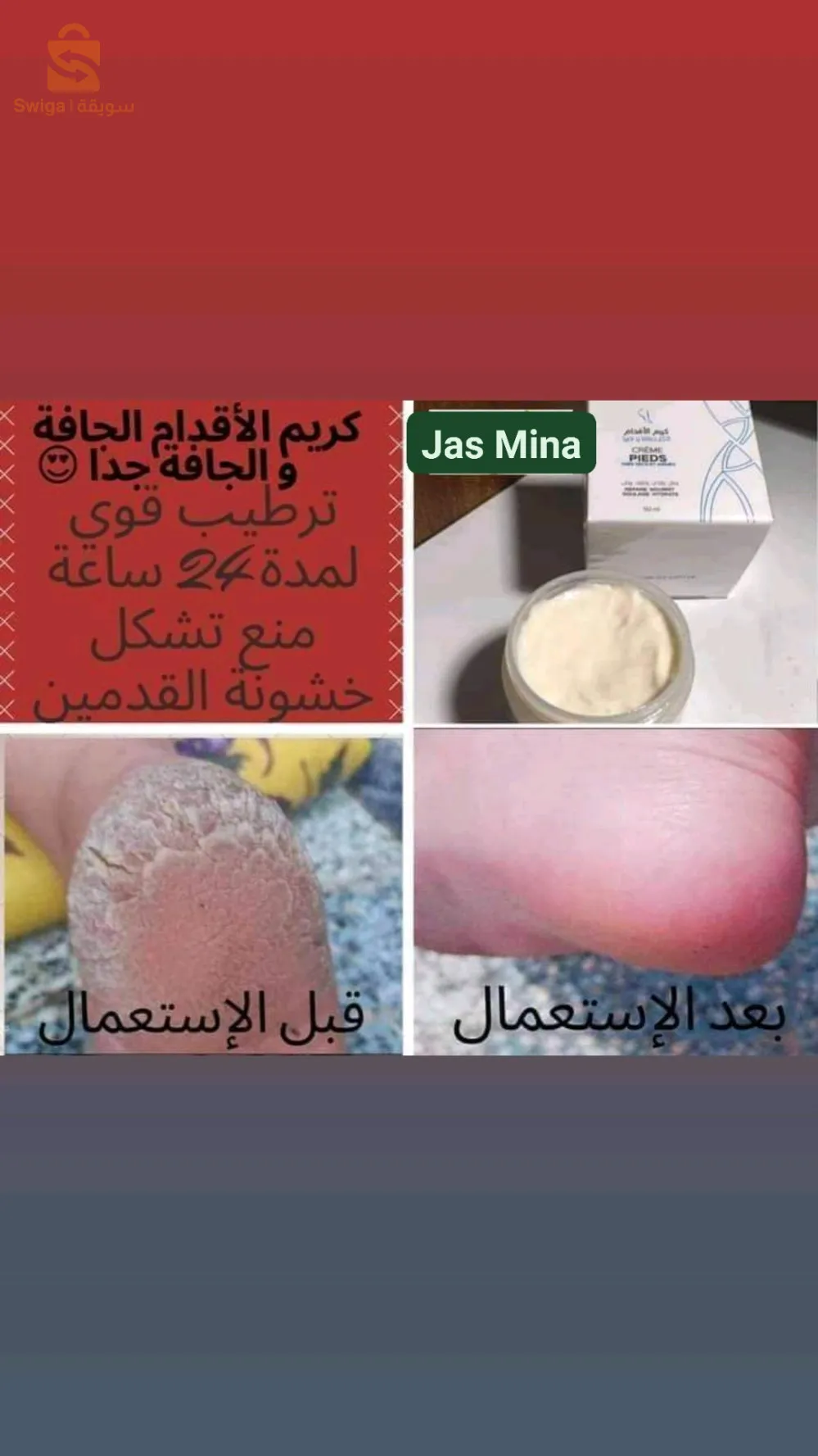كريم تشقق الأقدام
