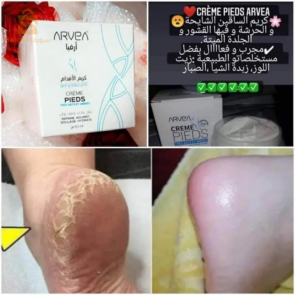 كريم تشقق الأقدام