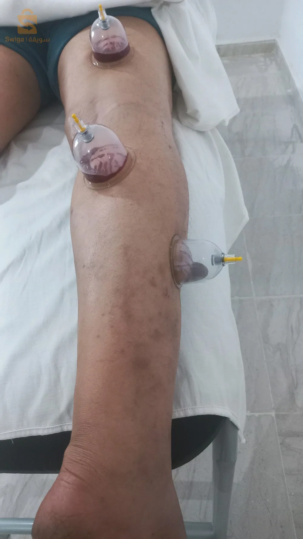 خدمات الحجامة والتدليك المنزلي والمتنقل