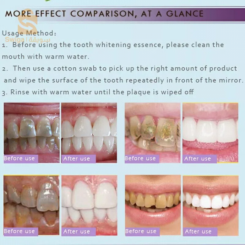 🤩🤩🤩🤩🤩🤩🤩🤩🤩🤩
*مبيض  الأسنان* 🦷 *RTOPR* 🦷 من شركة جينيس الفرنسية
مناسب تماما لللأشخاص الذين يعانون من مشاكل التصبغات والاصفرار❤
الممـيـزات✨ : 
-💠يبيض ويلمع ويضيئ الاسنان بشكل ٱمن
-💠 يزيل البقع  والاصفرار على الاسنان😍
- 💠يقلل من حساسية الاسنان ✨
- 💠يبيض الاسنان من اول استعمالات  ✨  
-💠يقلل من حساسية الاسنان😉
*كيفية الاستعمال*
🌸قبل استخدام جوهر تبيض الاسنان يجب تنظيف الفم بالماء الدافئ ثم استخدام اعواد قطنية لغمس كمية مناسبه من المنتج امسح سطح الاسنان بشكل متكرر امام المرآة… لمدة دقيقة ثم اشطفيه بالماء الدافى وقومي بتنظيف الفم//// ملاحظة  مسح  الاسنان بالمنتج بلطف  حتى لاتظر اللثة والغشاء المخاطي للفم*