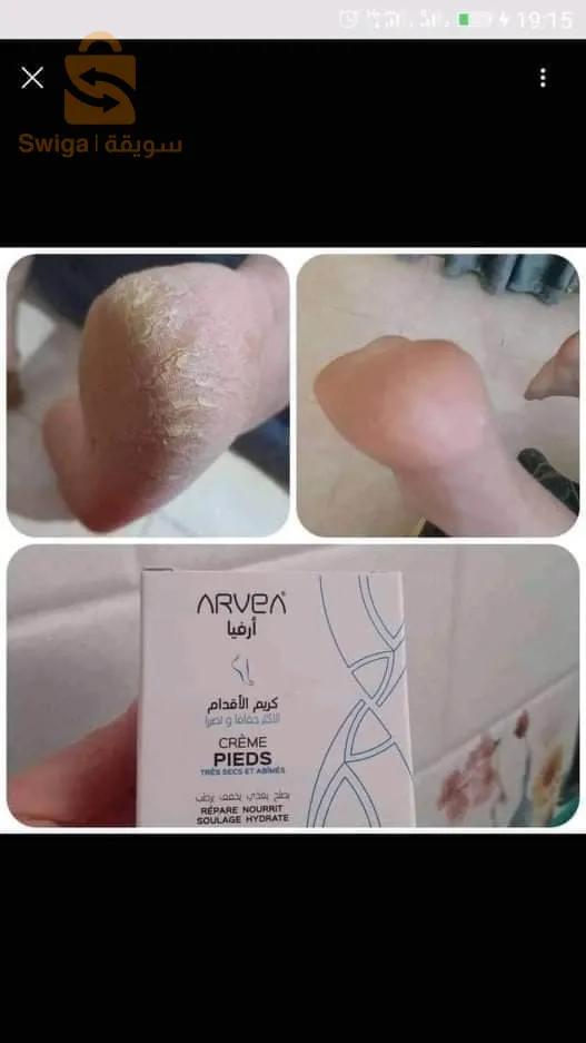كريم تشقق الأقدام