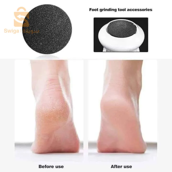ترطيب الارجل و إزالة التشقفات و الجلد الميت Callus Remover with Vacuum