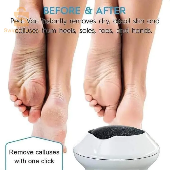 ترطيب الارجل و إزالة التشقفات و الجلد الميت Callus Remover with Vacuum