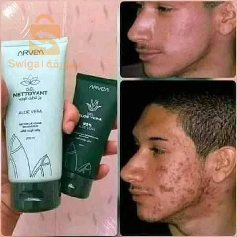 الحميز