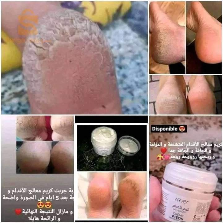الحميز