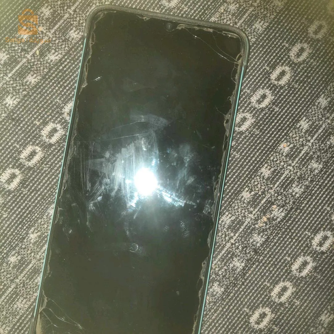 سالي رقان ادرار