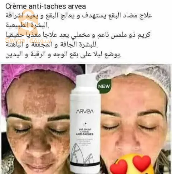 الحميز