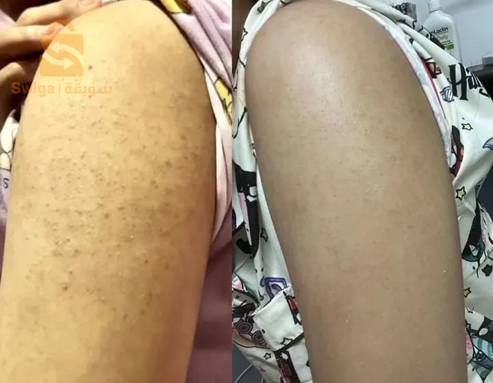 صابونة الكركم لعلاج مشاكل البشرة