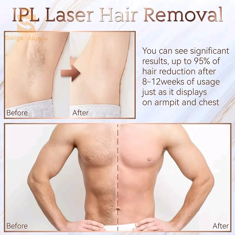 ipl laser original foton