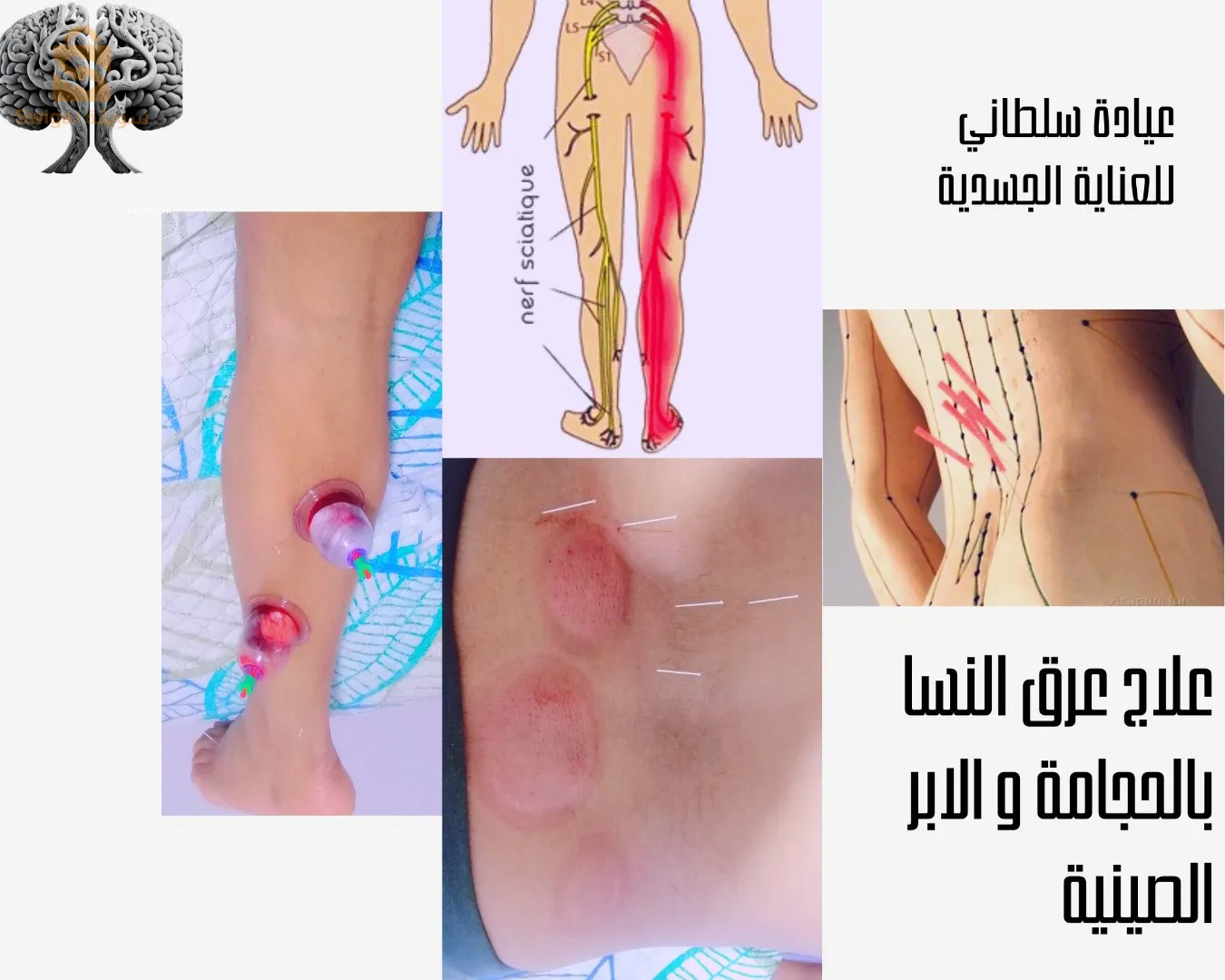 عبادة د.سلطاني للحجامة و الطب البديل سيدي بلعباس