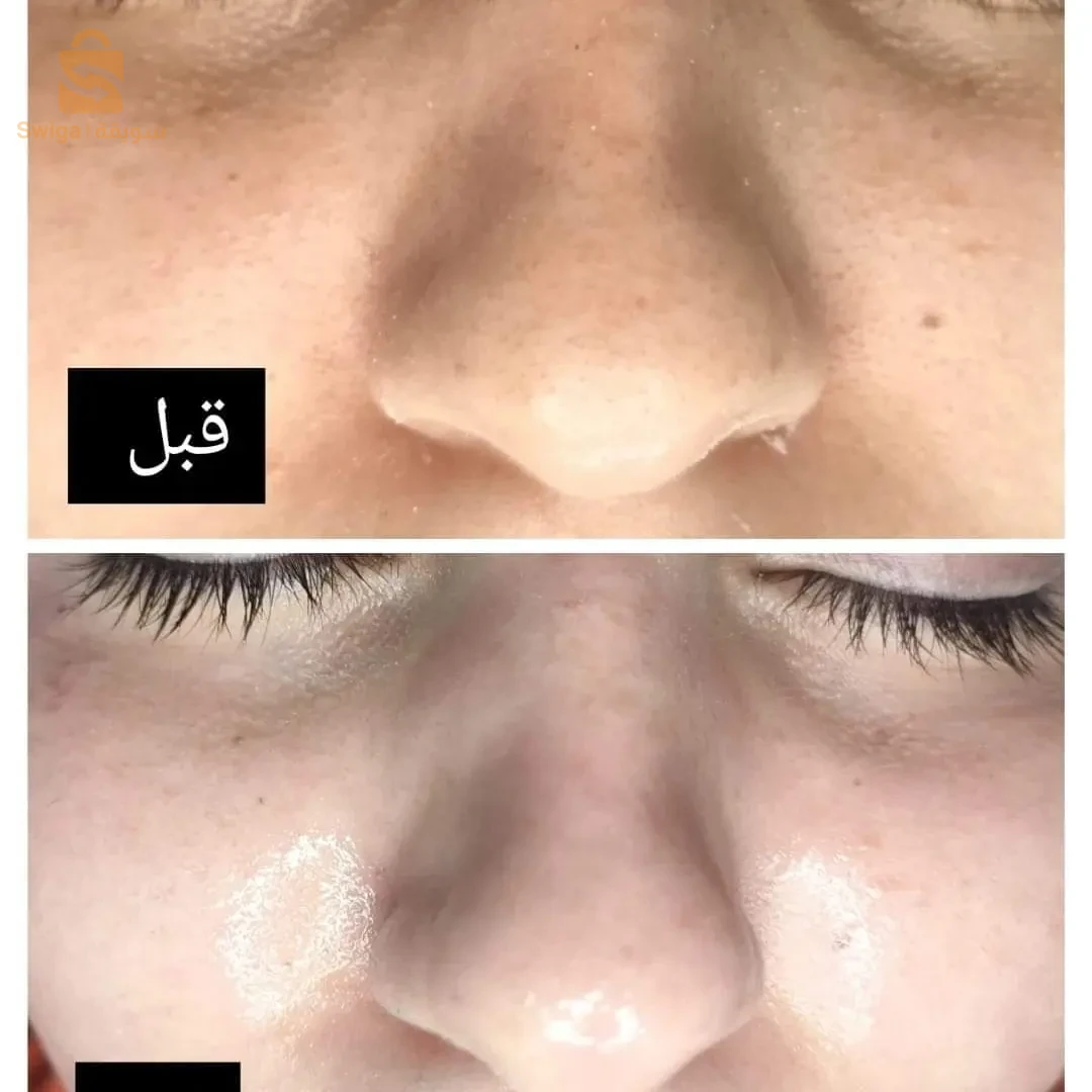 القرية الشراقة