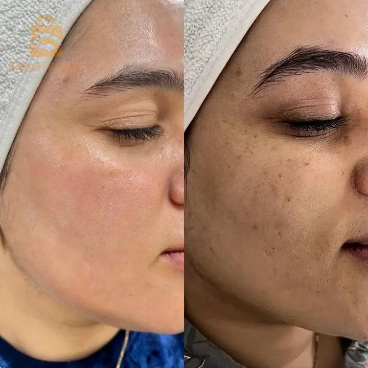 صابونة الكركم لعلاج مشاكل البشرة