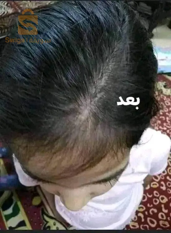 زيت أم الجود الشعر