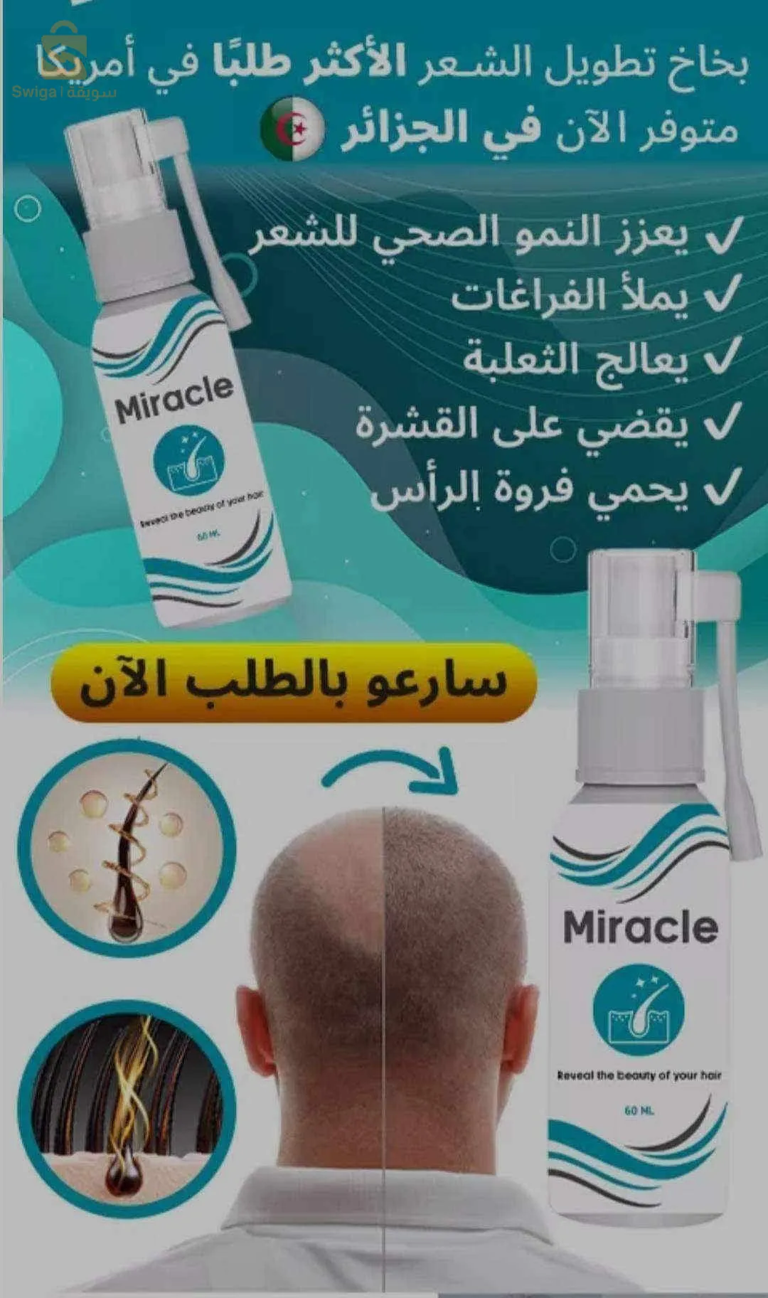 ميراكل للشعر