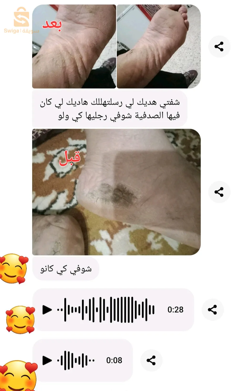 pomade pour exema et chompinion